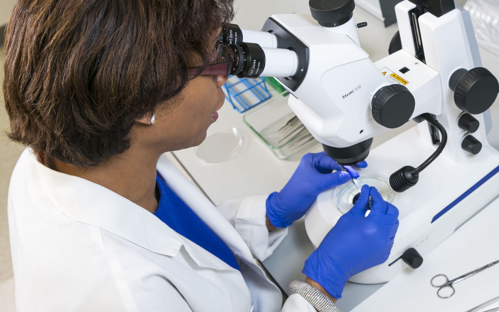 clinical trial of beyond contact lenses clinical trial of beyond contact lenses