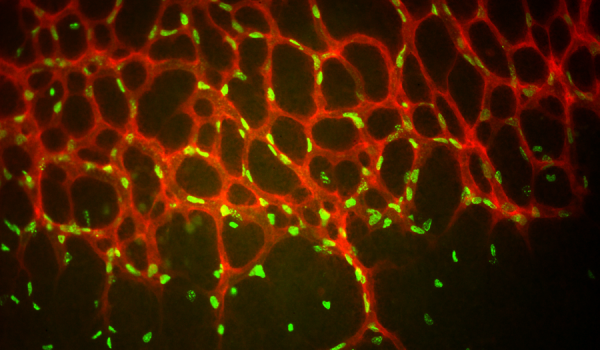 Retina Research Image