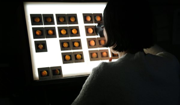 Fundus Photograph Reading Center