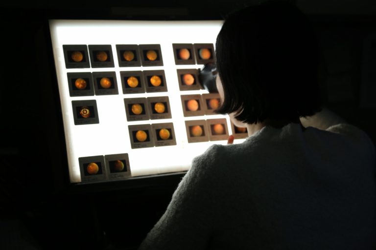 Fundus Photograph Reading Center