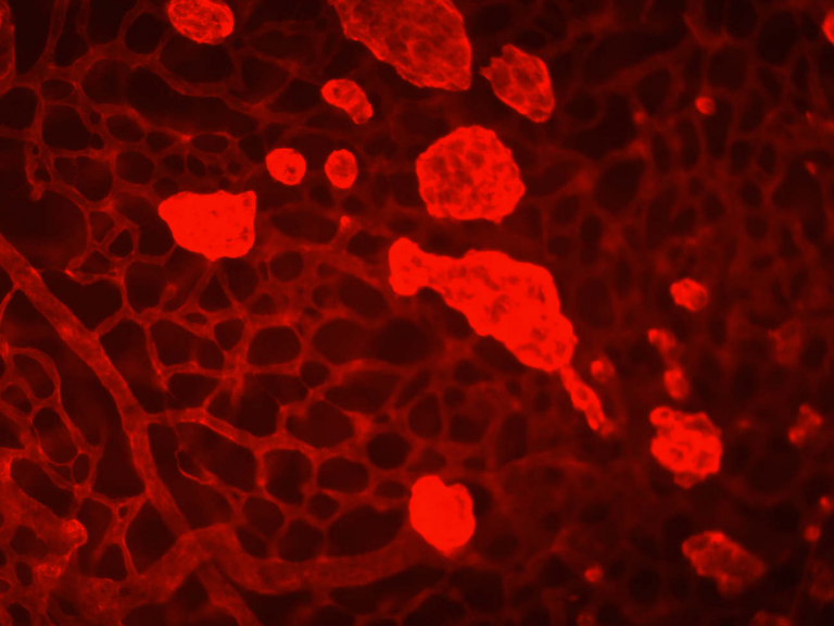Retina Research