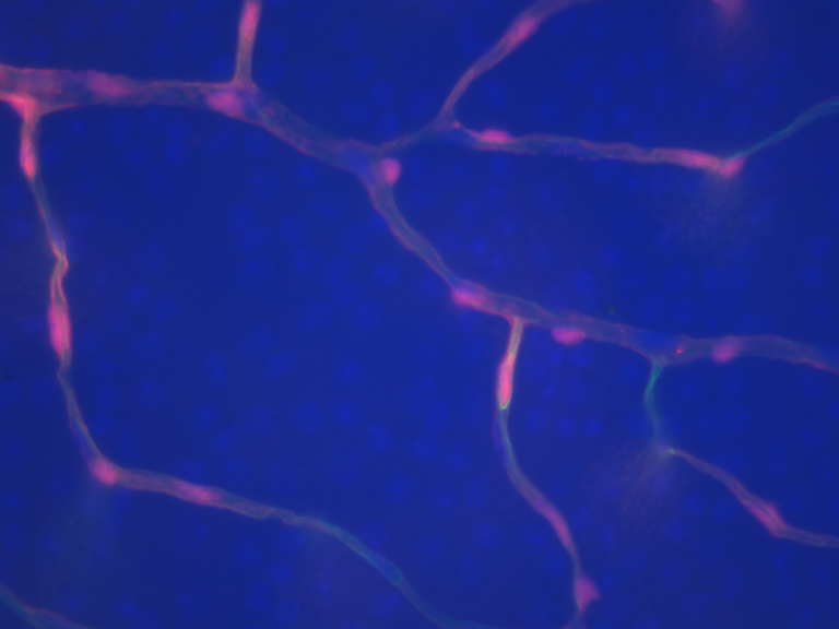 Retina Research