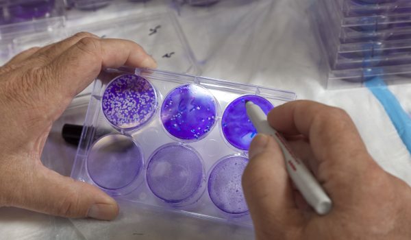 Labeling Lab Tests