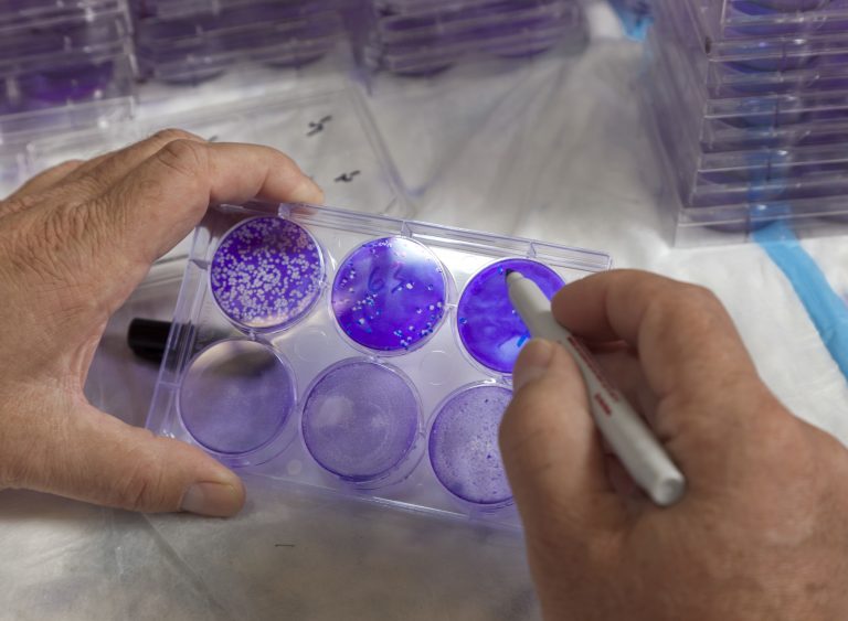 Labeling Lab Tests