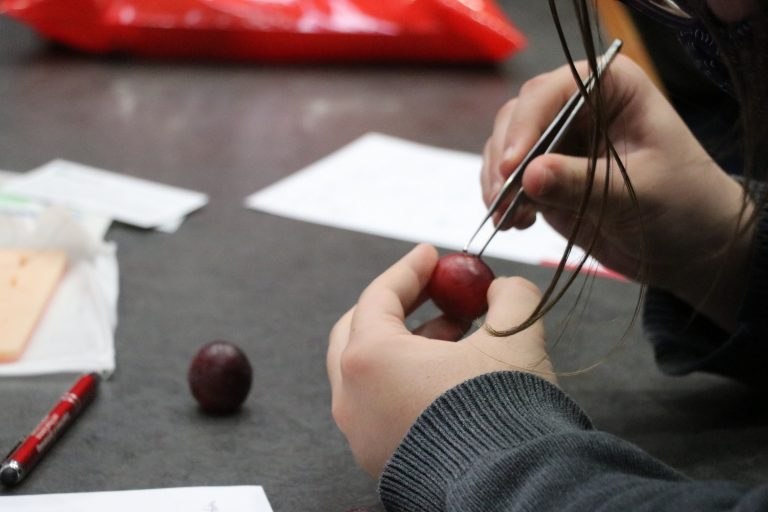 A student performs a surgical skill on a grape during last months's ophthalmology training course.