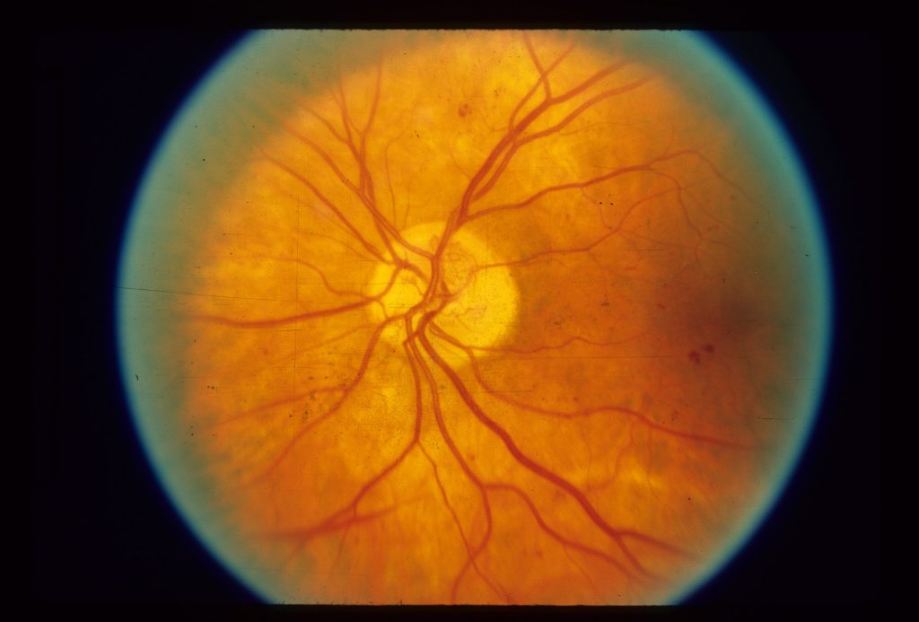 Scientific eye image