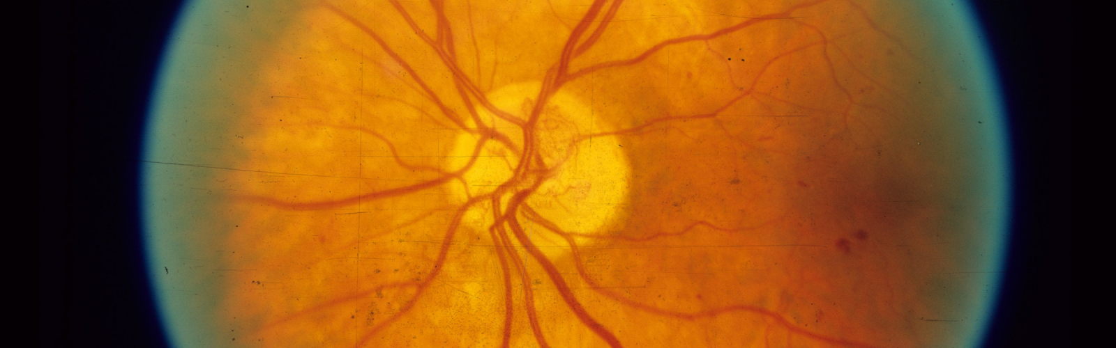 Scientific eye image