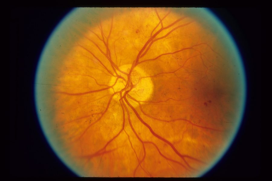 Scientific eye image