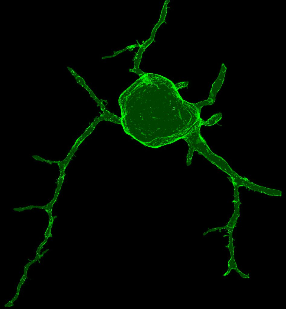 A 3D reconstruction of the primary arbors of a mouse retinal ganglion (output) cell using serial block face scanning electron microscopy. Serial images were aligned and the ganglion cell traced using the TrakEM module of ImageJ.